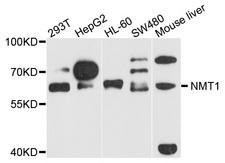 NMT1 Antibody - Western blot analysis of extract of various cells.