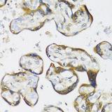 NMT1 Antibody - Immunohistochemistry of paraffin-embedded Human placenta using NMT1 Polyclonal Antibody at dilution of 1:100 (40x lens).