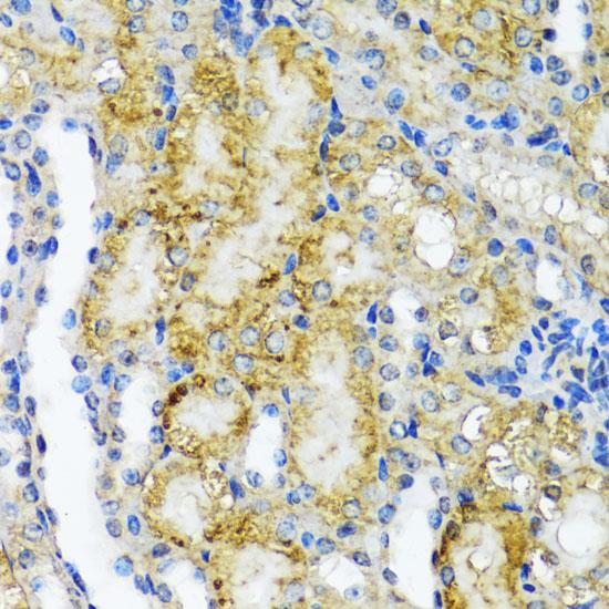 NMT1 Antibody - Immunohistochemistry of paraffin-embedded Mouse kidney using NMT1 Polyclonal Antibody at dilution of 1:100 (40x lens).