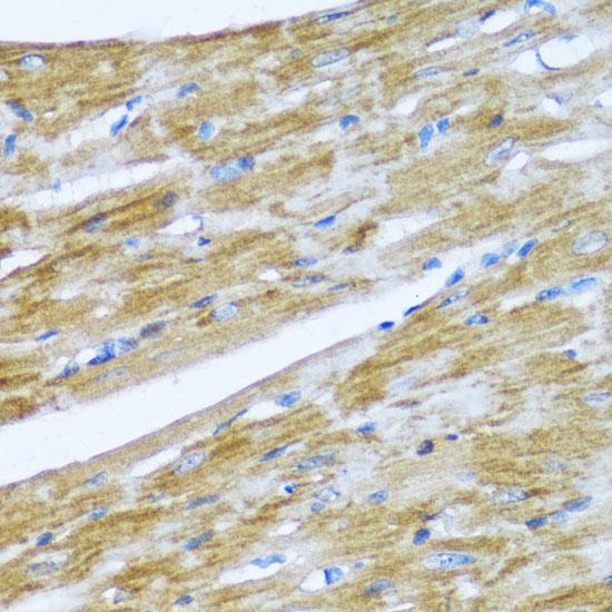 NMT1 Antibody - Immunohistochemistry of paraffin-embedded Mouse heart using NMT1 Polyclonal Antibody at dilution of 1:100 (40x lens).