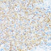 NMT1 Antibody - Immunohistochemistry of paraffin-embedded Rat ovary using NMT1 Polyclonal Antibody at dilution of 1:100 (40x lens).