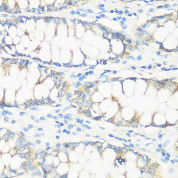 NMT1 Antibody - Immunohistochemistry of paraffin-embedded Human colon using NMT1 Polyclonal Antibody at dilution of 1:100 (40x lens).