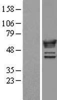 NMT1 Protein - Western validation with an anti-DDK antibody * L: Control HEK293 lysate R: Over-expression lysate