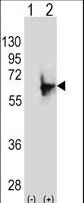 NMT2 Antibody - Western blot of NMT2 (arrow) using rabbit polyclonal NMT2 Antibody (E31). 293 cell lysates (2 ug/lane) either nontransfected (Lane 1) or transiently transfected (Lane 2) with the NMT2 gene.