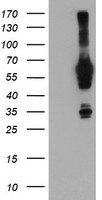 NMT2 Antibody - HEK293T cells were transfected with the pCMV6-ENTRY control (Left lane) or pCMV6-ENTRY NMT2 (Right lane) cDNA for 48 hrs and lysed. Equivalent amounts of cell lysates (5 ug per lane) were separated by SDS-PAGE and immunoblotted with anti-NMT2.