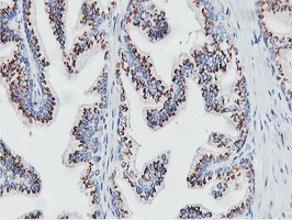 NMT2 Antibody - IHC of paraffin-embedded Human prostate tissue using anti-NMT2 mouse monoclonal antibody.