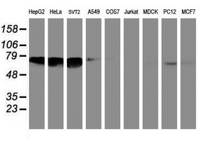 NMT2 Antibody - Western blot of extracts (35 ug) from 9 different cell lines by using anti-NMT2 monoclonal antibody.