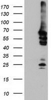 NMT2 Antibody - HEK293T cells were transfected with the pCMV6-ENTRY control (Left lane) or pCMV6-ENTRY NMT2 (Right lane) cDNA for 48 hrs and lysed. Equivalent amounts of cell lysates (5 ug per lane) were separated by SDS-PAGE and immunoblotted with anti-NMT2.