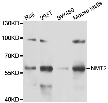 NMT2 Antibody - Western blot analysis of extracts of various cell lines.