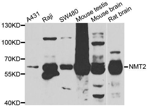 NMT2 Antibody - Western blot analysis of extracts of various cell lines.