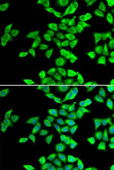 NMT2 Antibody - Immunofluorescence analysis of U20S cells.