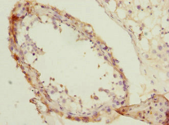 NMT2 Antibody - Immunohistochemistry of paraffin-embedded human testis tissue at dilution 1:100