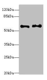 NMT2 Antibody - Western blot All lanes: NMT2 antibody at 4.99µg/ml Lane 1: Human placenta tissue Lane 2: K562 whole cell lysate Secondary Goat polyclonal to rabbit IgG at 1/10000 dilution Predicted band size: 57 kDa Observed band size: 57 kDa
