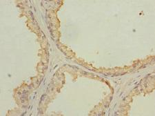 NMT2 Antibody - Immunohistochemistry of paraffin-embedded human prostate tissue at dilution 1:100
