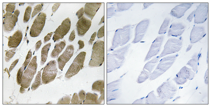 NMU / Neuromedin U Antibody - Immunohistochemistry analysis of paraffin-embedded human skeletal muscle tissue, using NMU Antibody. The picture on the right is blocked with the synthesized peptide.