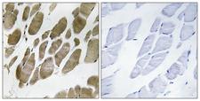 NMU / Neuromedin U Antibody - Immunohistochemistry analysis of paraffin-embedded human skeletal muscle tissue, using NMU Antibody. The picture on the right is blocked with the synthesized peptide.