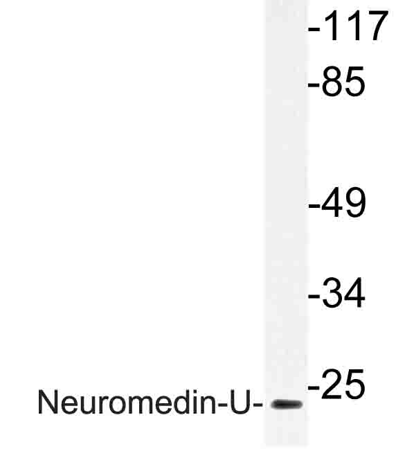 NMU / Neuromedin U Antibody - Western blot of Neuromedin-U (I174) pAb in extracts from HepG2 cells.