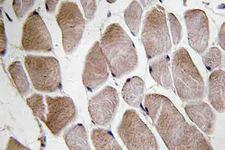 NMU / Neuromedin U Antibody - IHC of Neuromedin-U (I174) pAb in paraffin-embedded human skeletal muscle tissue.