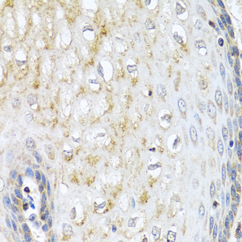 NMU / Neuromedin U Antibody - Immunohistochemistry of paraffin-embedded human esophagus using NMU antibody at dilution of 1:100 (40x lens).