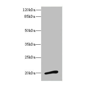 NMU / Neuromedin U Antibody - Western blot All Lanes: NMUantibody at 3.13ug/ml+ Mouse stomach tissue Goat polyclonal to rabbit at 1/10000 dilution Predicted band size: 20 kDa Observed band size: 20 kDa