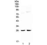NMU / Neuromedin U Antibody - Western blot testing of 1) rat kidney and 2) mouse kidney lysate with NMU antibody at 0.5ug/ml. Expected molecular weight: 20-25 kDa.