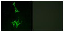 NMUR1 Antibody - Immunofluorescence analysis of LOVO cells, using NMUR1 Antibody. The picture on the right is blocked with the synthesized peptide.