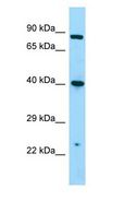 NMUR1 Antibody - NMUR1 antibody Western Blot of A549 cell lysate. NMUR1 is supported by BioGPS gene expression data to be expressed in A549.  This image was taken for the unconjugated form of this product. Other forms have not been tested.
