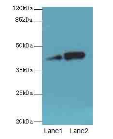 NMUR1 Antibody - Western blot. All lanes: NMUR1 antibody at 2 ug/ml. Lane 1: Mouse liver tissue. Lane 2: Mouse kidney tissue. Secondary Goat polyclonal to Rabbit IgG at 1:10000 dilution. Predicted band size: 47 kDa. Observed band size: 47 kDa.