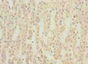 NMUR1 Antibody - Immunohistochemistry of paraffin-embedded human adrenal gland tissue using antibody at dilution of 1:100.