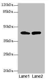 NMUR1 Antibody - Western blot All lanes: NMUR1 antibody at 2µg/ml Lane 1: Mouse liver tissue Lane 2: Mouse kidney tissue Secondary Goat polyclonal to rabbit IgG at 1/10000 dilution Predicted band size: 47 kDa Observed band size: 47 kDa
