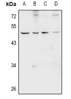 NMUR1 Antibody - Western blot analysis of GPR66 expression in rat testis (A), mouse testis (B), SGC7901 (C), K562 (D) whole cell lysates.