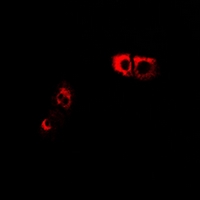 NMUR1 Antibody - Immunofluorescent analysis of GPR66 staining in LOVO cells. Formalin-fixed cells were permeabilized with 0.1% Triton X-100 in TBS for 5-10 minutes and blocked with 3% BSA-PBS for 30 minutes at room temperature. Cells were probed with the primary antibody in 3% BSA-PBS and incubated overnight at 4 °C in a hidified chamber. Cells were washed with PBST and incubated with Alexa Fluor 647-conjugated secondary antibody (red) in PBS at room temperature in the dark.