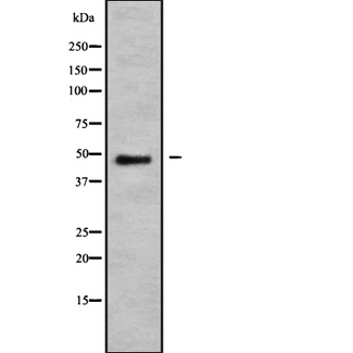 NMUR1 Antibody - Western blot analysis NMUR1 using K562 whole cells lysates