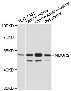 NMUR2 Antibody - Western blot analysis of extracts of various cell lines, using NMUR2 antibody at 1:3000 dilution. The secondary antibody used was an HRP Goat Anti-Rabbit IgG (H+L) at 1:10000 dilution. Lysates were loaded 25ug per lane and 3% nonfat dry milk in TBST was used for blocking. An ECL Kit was used for detection and the exposure time was 30s.