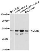NMUR2 Antibody - Western blot analysis of extracts of various cell lines, using NMUR2 antibody at 1:3000 dilution. The secondary antibody used was an HRP Goat Anti-Rabbit IgG (H+L) at 1:10000 dilution. Lysates were loaded 25ug per lane and 3% nonfat dry milk in TBST was used for blocking. An ECL Kit was used for detection and the exposure time was 30s.