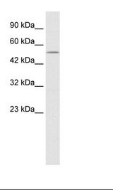 NMUR2 Antibody - Jurkat Cell Lysate.  This image was taken for the unconjugated form of this product. Other forms have not been tested.