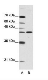 NMUR2 Antibody - A: Marker, B: HepG2 Cell Lysate.  This image was taken for the unconjugated form of this product. Other forms have not been tested.