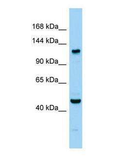 NNA1 / AGTPBP1 Antibody - Western blot of Agtpbp1 Antibody - C-terminal region in Mouse Testis cells lysate.  This image was taken for the unconjugated form of this product. Other forms have not been tested.