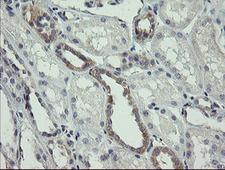 NNA1 / AGTPBP1 Antibody - IHC of paraffin-embedded Human Kidney tissue using anti-AGTPBP1 mouse monoclonal antibody.