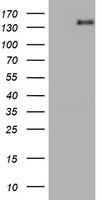 NNA1 / AGTPBP1 Antibody - HEK293T cells were transfected with the pCMV6-ENTRY control (Left lane) or pCMV6-ENTRY AGTPBP1 (Right lane) cDNA for 48 hrs and lysed. Equivalent amounts of cell lysates (5 ug per lane) were separated by SDS-PAGE and immunoblotted with anti-AGTPBP1.