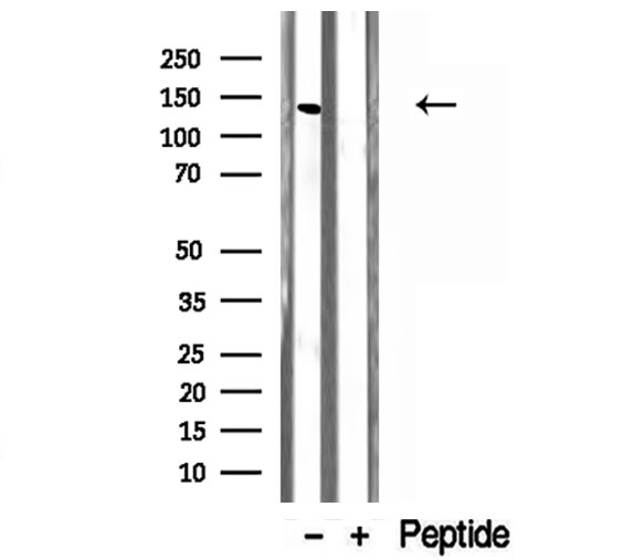 NNA1 / AGTPBP1 Antibody - Western blot analysis of extracts of A549 cells using CCP1 antibody.