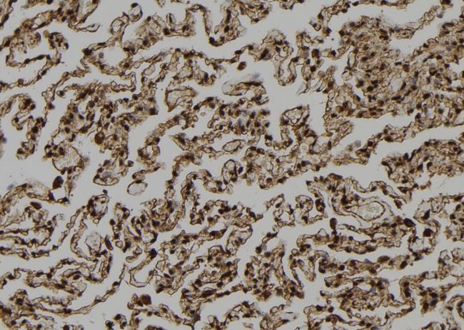 NNA1 / AGTPBP1 Antibody - 1:100 staining human lung tissue by IHC-P. The sample was formaldehyde fixed and a heat mediated antigen retrieval step in citrate buffer was performed. The sample was then blocked and incubated with the antibody for 1.5 hours at 22°C. An HRP conjugated goat anti-rabbit antibody was used as the secondary.