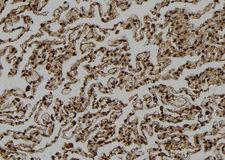 NNA1 / AGTPBP1 Antibody - 1:100 staining human lung tissue by IHC-P. The sample was formaldehyde fixed and a heat mediated antigen retrieval step in citrate buffer was performed. The sample was then blocked and incubated with the antibody for 1.5 hours at 22°C. An HRP conjugated goat anti-rabbit antibody was used as the secondary.