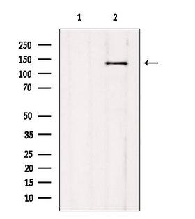 NNA1 / AGTPBP1 Antibody - Western blot analysis of extracts of mouse brain tissue using CCP1 antibody. Lane 1 was treated with the blocking peptide.