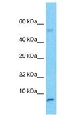NNAT / Neuronatin Antibody - NNAT / Neuronatin antibody Western Blot of Fetal Heart. Antibody dilution: 1 ug/ml.  This image was taken for the unconjugated form of this product. Other forms have not been tested.