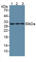 NNMT Antibody - Western Blot; Sample: Lane1: Human Hela Cells; Lane2: Human A549 Cells; Lane3: Human U2OS Cells.