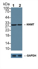 NNMT Antibody - Knockout Varification: Lane 1: Wild-type A549 cell lysate; Lane 2: NNMT knockout A549 cell lysate; Predicted MW: 30kd Observed MW: 30kd Primary Ab: 1µg/ml Rabbit Anti-Human NNMT Antibody Second Ab: 0.2µg/mL HRP-Linked Caprine Anti-Rabbit IgG Polyclonal Antibody