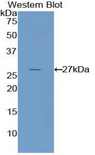 NNMT Antibody - Western blot of recombinant NNMT.  This image was taken for the unconjugated form of this product. Other forms have not been tested.
