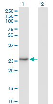NNMT Antibody - Western Blot analysis of NNMT expression in transfected 293T cell line by NNMT monoclonal antibody (M03), clone 2F2.Lane 1: NNMT transfected lysate(29.6 KDa).Lane 2: Non-transfected lysate.