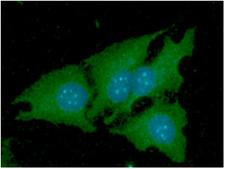 NNMT Antibody - ICC/IF analysis of NNMT in HeLa cells line, stained with DAPI (Blue) for nucleus staining and monoclonal anti-human NNMT antibody (1:100) with goat anti-mouse IgG-Alexa fluor 488 conjugate (Green).